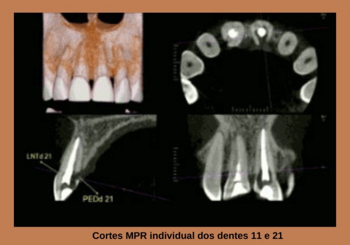 A Evolução da Tomografia Cone Beam