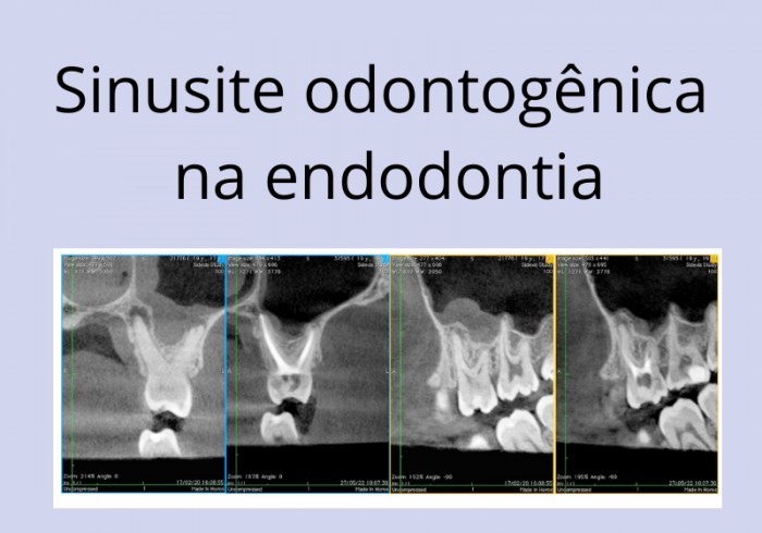 Científica: Endodontia