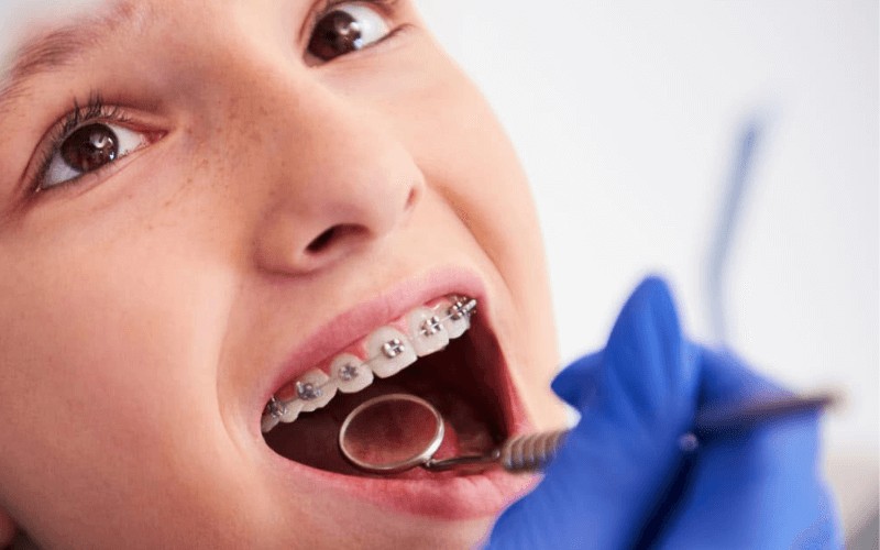 Ortodontistas alertam