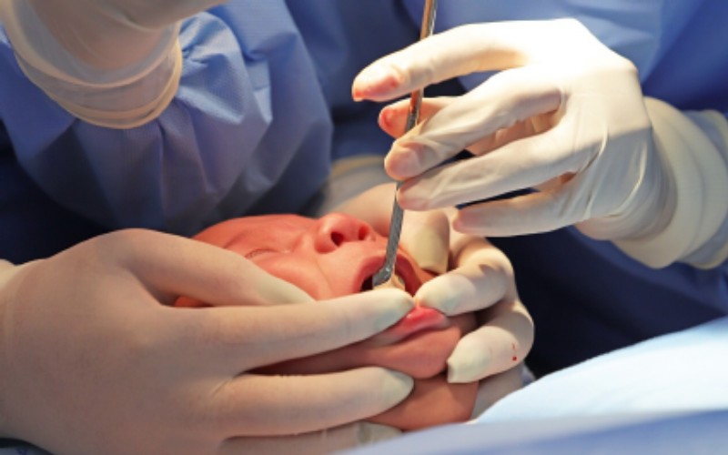 Conheça a cirurgia que voltou a popularizar após caso de filho da influenciadora Viih Tube FRENECCTOMIA