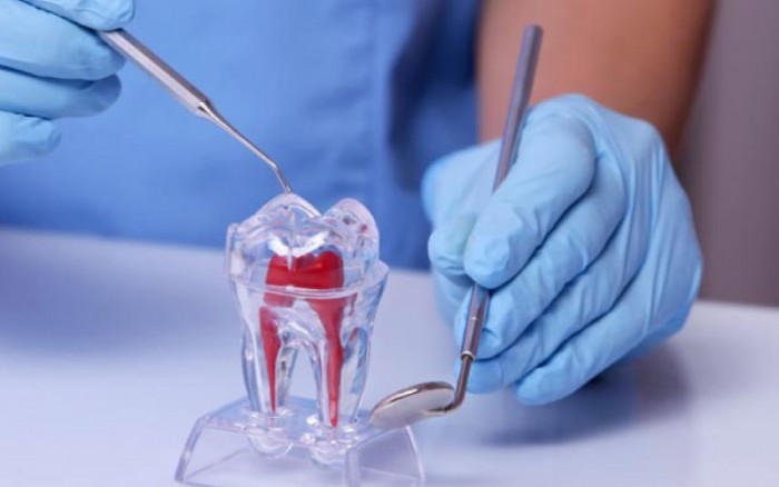 Motivados pela demanda profissionais buscam se especializar em Endodontia