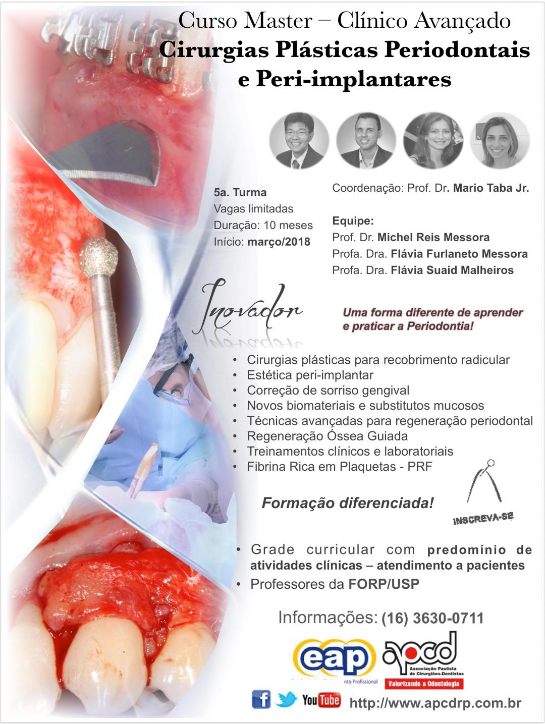 Cirurgias Plásticas Periodontais e Peri-implantares