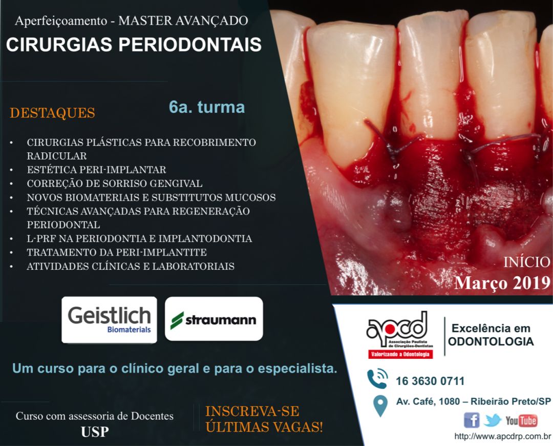 Atualização em Periodontia com Ênfase em Regeneração Estética e Gengival