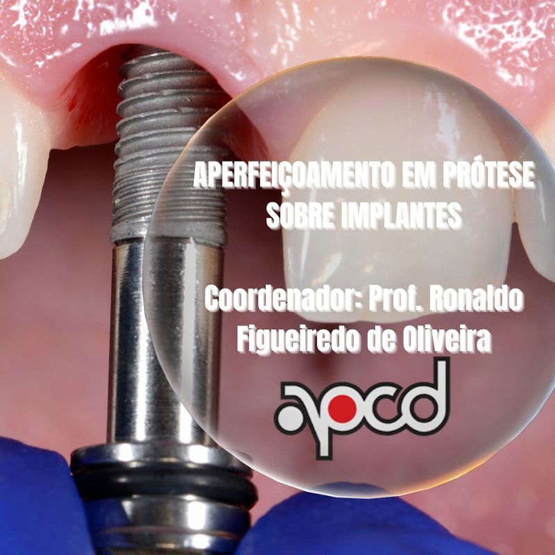 EAP: Aperfeiçoamento em Prótese sobre Implantes