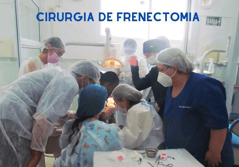 Frenectomia: cirurgia simples pós operatório tranquilo