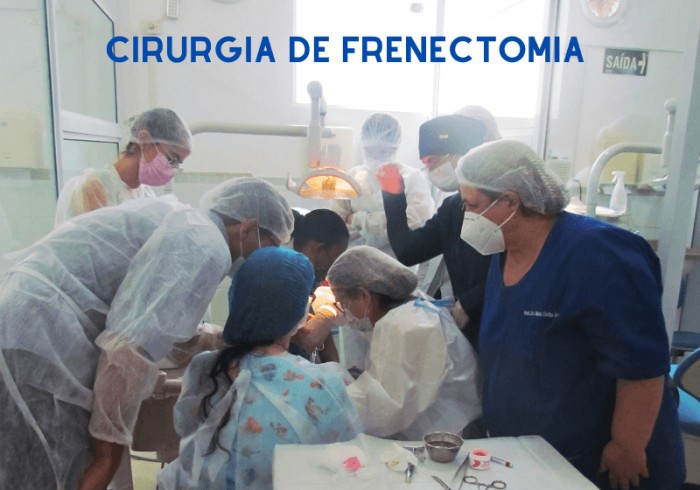 Frenectomia: cirurgia simples pós operatório tranquilo